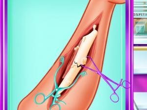 العاب عمليات جراحية